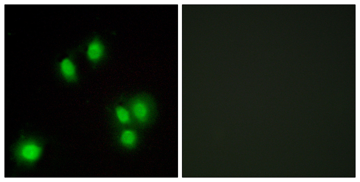 CR6 / GADD45G Antibody - Immunofluorescence analysis of A549 cells, using GA45G Antibody. The picture on the right is blocked with the synthesized peptide.