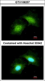 CR6 / GADD45G Antibody - Immunofluorescence of methanol-fixed HeLa using GADD45 gamma antibody at 1:200 dilution.