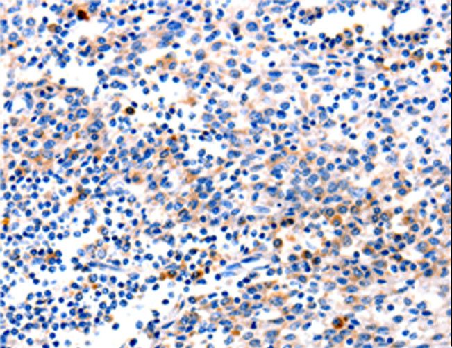CR6 / GADD45G Antibody - Immunohistochemistry of paraffin-embedded Human tonsil using GADD45G Polyclonal Antibody at dilution of 1:120.