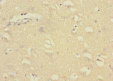 CR6 / GADD45G Antibody - Immunohistochemistry of paraffin-embedded human brain tissue at dilution 1:100