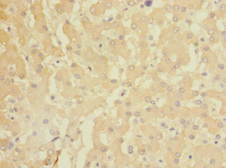 CR6 / GADD45G Antibody - Immunohistochemistry of paraffin-embedded human liver tissue at dilution 1:100