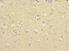 CR6 / GADD45G Antibody - Immunohistochemistry of paraffin-embedded human brain tissue at dilution 1:100