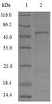 APOC3 / Apolipoprotein C III Protein - (Tris-Glycine gel) Discontinuous SDS-PAGE (reduced) with 5% enrichment gel and 15% separation gel.