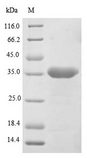 LGMN / Legumain Protein - (Tris-Glycine gel) Discontinuous SDS-PAGE (reduced) with 5% enrichment gel and 15% separation gel.