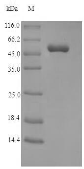 MBP / Myelin Basic Protein Protein - (Tris-Glycine gel) Discontinuous SDS-PAGE (reduced) with 5% enrichment gel and 15% separation gel.
