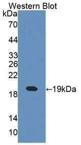 CRABP1 / CRABP Antibody - Western blot of CRABP1 / CRABP antibody.