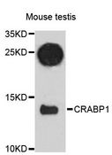 CRABP1 / CRABP Antibody - Western blot analysis of extracts of mouse testis, using CRABP1 antibody at 1:3000 dilution. The secondary antibody used was an HRP Goat Anti-Rabbit IgG (H+L) at 1:10000 dilution. Lysates were loaded 25ug per lane and 3% nonfat dry milk in TBST was used for blocking. An ECL Kit was used for detection and the exposure time was 90s.