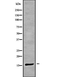 CRABP1 / CRABP Antibody - Western blot analysis of CRABP1 using COLO205 whole cells lysates
