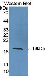CRABP2 Antibody - Western blot of CRABP2 antibody.