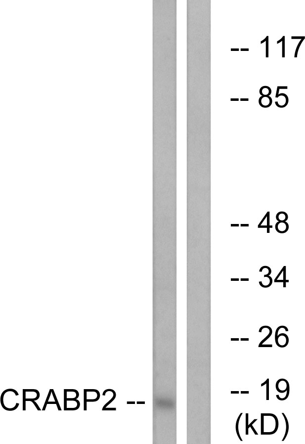 CRABP2 Antibody - Western blot analysis of lysates from HT-29 cells, using CRABP2 Antibody. The lane on the right is blocked with the synthesized peptide.