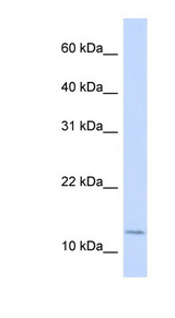 CRABP2 Antibody - CRABP2 antibody Western blot of 721_B cell lysate. This image was taken for the unconjugated form of this product. Other forms have not been tested.