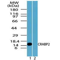CRABP2 Antibody - Western blot of CRABP2 in HCT116 cell lysate in the 1) absence and 2) presence of immunizing peptide using Polyclonal Antibody to CRABP2 at 1.0 ug/ml.