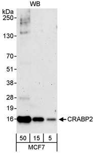 CRABP2 Antibody - Detection of Human CRABP2 by Western Blot. Samples: Whole cell lysate (5, 15 and 50 ug) from MCF7 cells. Antibodies: Affinity purified rabbit anti-CRABP2 antibody used for WB at 0.04 ug/ml. Detection: Chemiluminescence with an exposure time of 3 minutes.