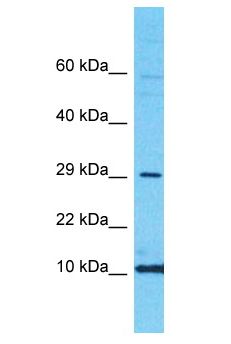 CRABP2 Antibody - CRABP2 antibody Western Blot of HeLa. Antibody dilution: 1 ug/ml.  This image was taken for the unconjugated form of this product. Other forms have not been tested.