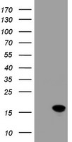 CRABP2 Antibody - HEK293T cells were transfected with the pCMV6-ENTRY control (Left lane) or pCMV6-ENTRY CRABP2 (Right lane) cDNA for 48 hrs and lysed. Equivalent amounts of cell lysates (5 ug per lane) were separated by SDS-PAGE and immunoblotted with anti-CRABP2.