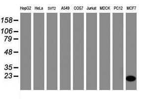 CRABP2 Antibody - Western blot of extracts (35 ug) from 9 different cell lines by using g anti-CRABP2 monoclonal antibody (HepG2: human; HeLa: human; SVT2: mouse; A549: human; COS7: monkey; Jurkat: human; MDCK: canine; PC12: rat; MCF7: human).