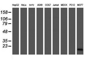 CRABP2 Antibody - Western blot of extracts (35 ug) from 9 different cell lines by using anti-CRABP2 monoclonal antibody (HepG2: human; HeLa: human; SVT2: mouse; A549: human; COS7: monkey; Jurkat: human; MDCK: canine; PC12: rat; MCF7: human).