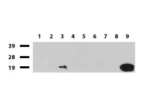 CRABP2 Antibody - Western blot of cell lysates. (35ug) from 9 different cell lines. (1: HepG2, 2: HeLa, 3: SV-T2, 4: A549, 5: COS7, 6: Jurkat, 7: MDCK, 8: PC-12, 9: MCF7). Diluation: 1:500