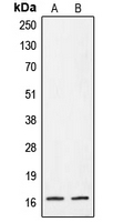 CRABP2 Antibody - Western blot analysis of CRABP2 expression in A431 (A); HeLa (B) whole cell lysates.