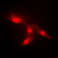 CRABP2 Antibody - Immunofluorescent analysis of CRABP2 staining in HeLa cells. Formalin-fixed cells were permeabilized with 0.1% Triton X-100 in TBS for 5-10 minutes and blocked with 3% BSA-PBS for 30 minutes at room temperature. Cells were probed with the primary antibody in 3% BSA-PBS and incubated overnight at 4 C in a humidified chamber. Cells were washed with PBST and incubated with a DyLight 594-conjugated secondary antibody (red) in PBS at room temperature in the dark. DAPI was used to stain the cell nuclei (blue).