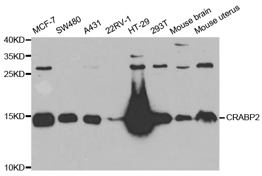 CRABP2 Antibody - Western blot analysis of extracts of various cell lines.