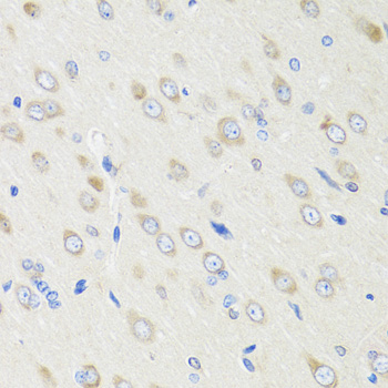 CRABP2 Antibody - Immunohistochemistry of paraffin-embedded rat brain tissue.