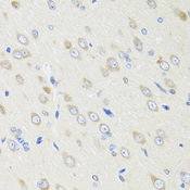 CRABP2 Antibody - Immunohistochemistry of paraffin-embedded rat brain tissue.