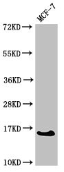 CRABP2 Antibody - Western Blot Positive WB detected in: MCF-7 whole cell lysate All lanes: CRABP2 antibody at 3µg/ml Secondary Goat polyclonal to rabbit IgG at 1/50000 dilution Predicted band size: 16 kDa Observed band size: 16 kDa