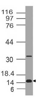 CRABP2 Antibody - Fig-1: Western blot analysis of CRABP2. Anti-CRABP2 antibody was used at 1 µg/ml on HT-29 lysate.