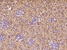 CRABP2 Antibody - Immunochemical staining of mouse CRABP2 in mouse kidney with rabbit polyclonal antibody at 1:300 dilution, formalin-fixed paraffin embedded sections.