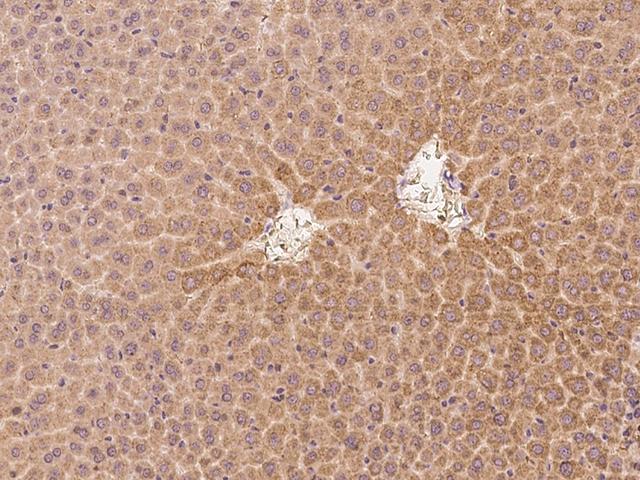 CRABP2 Antibody - Immunochemical staining of mouse CRABP2 in mouse liver with rabbit polyclonal antibody at 1:300 dilution, formalin-fixed paraffin embedded sections.