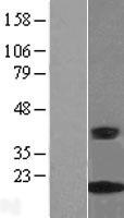 CRABP2 Protein - Western validation with an anti-DDK antibody * L: Control HEK293 lysate R: Over-expression lysate