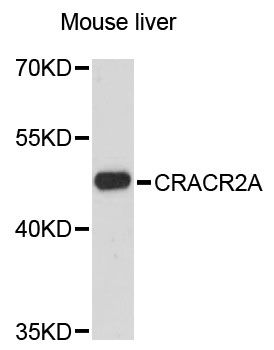 CRACR2A / EFCAB4B Antibody - Western blot analysis of extracts of mouse liver, using CRACR2A antibody at 1:3000 dilution. The secondary antibody used was an HRP Goat Anti-Rabbit IgG (H+L) at 1:10000 dilution. Lysates were loaded 25ug per lane and 3% nonfat dry milk in TBST was used for blocking. An ECL Kit was used for detection and the exposure time was 60s.
