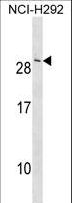 CRADD / RAIDD Antibody - CRADD Antibody western blot of NCI-H292 cell line lysates (35 ug/lane). The CRADD antibody detected the CRADD protein (arrow).