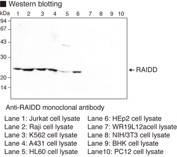 CRADD / RAIDD Antibody