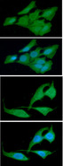 CRADD / RAIDD Antibody - ICC/IF analysis of CRADD in HeLa cells line, stained with DAPI (Blue) for nucleus staining and monoclonal anti-human CRADD antibody (1:100) with goat anti-mouse IgG-Alexa fluor 488 conjugate (Green).ICC/IF analysis of CRADD in PC3 cells line, stained with DAPI (Blue) for nucleus staining and monoclonal anti-human CRADD antibody (1:100) with goat anti-mouse IgG-Alexa fluor 488 conjugate (Green).