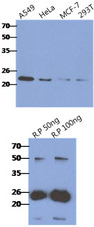 CRADD / RAIDD Antibody - Fig.1: The cell lysates of A549, HeLa, MCF-7 and 293T (40ug) were resolved by SDS-PAGE, transferred to PVDF membrane and probed with anti-human CRADD antibody (1:500). Proteins were visualized using a goat anti-mouse secondary antibody conjugated to HRP and an ECL detection system. Fig2: The Recombinant Human CRADD (50,100ng) were resolved by SDS-PAGE, transferred to PVDF membrane and probed with anti-human CRADD antibody (1:1000). Proteins were visualized using a goat anti-mouse secondary antibody conjugated to HRP and an ECL detection system.