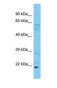 CRADD / RAIDD Antibody - Western blot of CRADD Antibody with human Fetal Kidney lysate.  This image was taken for the unconjugated form of this product. Other forms have not been tested.