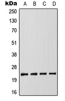 CRADD / RAIDD Antibody - Western blot analysis of RAIDD expression in MCF7 (A); K562 (B); SP2/0 (C); PC12 (D) whole cell lysates.