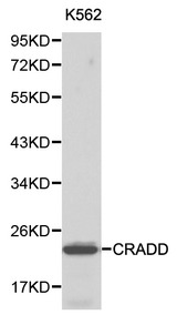 CRADD / RAIDD Antibody - Western blot of CRADD pAb in extracts from K562 cells.