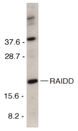 CRADD / RAIDD Antibody - Western blot of RAIDD in HeLa total cell lysate with RAIDD antibody at 1 ug/ml.