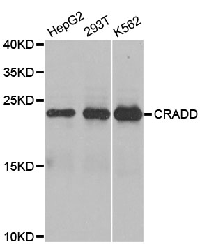 CRADD / RAIDD Antibody - Western blot analysis of extracts of various cell lines, using CRADD antibody at 1:1000 dilution. The secondary antibody used was an HRP Goat Anti-Rabbit IgG (H+L) at 1:10000 dilution. Lysates were loaded 25ug per lane and 3% nonfat dry milk in TBST was used for blocking. An ECL Kit was used for detection and the exposure time was 10s.