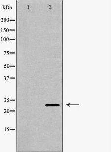 CRADD / RAIDD Antibody - Western blot analysis of K562 lysate usingCRADD antibody. The lane on the left is treated with the antigen-specific peptide.