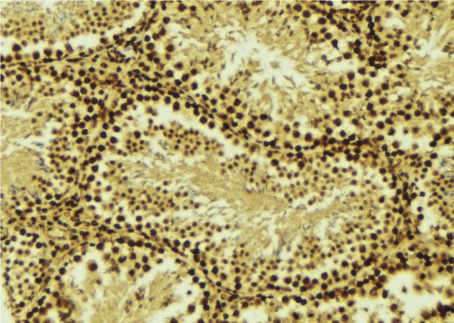 CRADD / RAIDD Antibody - 1:100 staining mouse testis tissue by IHC-P. The sample was formaldehyde fixed and a heat mediated antigen retrieval step in citrate buffer was performed. The sample was then blocked and incubated with the antibody for 1.5 hours at 22°C. An HRP conjugated goat anti-rabbit antibody was used as the secondary.