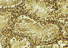 CRADD / RAIDD Antibody - 1:100 staining mouse testis tissue by IHC-P. The sample was formaldehyde fixed and a heat mediated antigen retrieval step in citrate buffer was performed. The sample was then blocked and incubated with the antibody for 1.5 hours at 22°C. An HRP conjugated goat anti-rabbit antibody was used as the secondary.