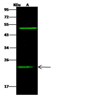 CRADD / RAIDD Antibody - Anti-CRADD rabbit polyclonal antibody at 1:500 dilution. Lane A: K562 Whole Cell Lysate. Lysates/proteins at 30 ug per lane. Secondary: Goat Anti-Rabbit IgG H&L (Dylight 800) at 1/10000 dilution. Developed using the Odyssey technique. Performed under reducing conditions. Predicted band size: 23 kDa. Observed band size: 23 kDa. (We are unsure as to the identity of these extra bands.)