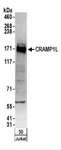 CRAMP1L Antibody - Detection of Human CRAMP1L by Western Blot. Samples: Whole cell lysate (50 ug) from Jurkat cells. Antibodies: Affinity purified rabbit anti-CRAMP1L antibody used for WB at 0.1 ug/ml. Detection: Chemiluminescence with an exposure time of 3 minutes.