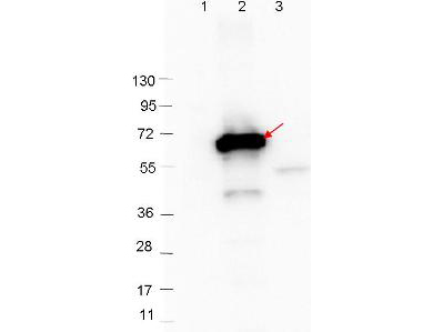 CRASP-2 Antibody - Western Blot showing detection of 0.1 µg of recombinant CRASP-2 protein. Lane 1: Molecular weight markers. Lane 2: MBP-CRASP-2 fusion protein (arrow; expected MW = 67.8 kDa). Lane 3: MBP alone. Protein was run on a 4-20% gel, then transferred to 0.45 µm nitrocellulose. After blocking with 1% BSA-TTBS overnight at 4°C, primary antibody was used at 1:1000 at room temperature for 30 min. HRP-conjugated Goat-Anti-Rabbit secondary antibody was used at 1:40,000 in MB-070 blocking buffer and imaged on the VersaDoc MP 4000 imaging system (Bio-Rad).