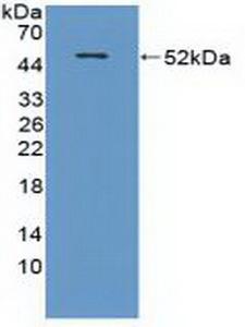 CRAT Antibody - Western Blot; Sample: Recombinant CRAT, Mouse.