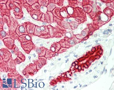 CRAT Antibody - Human Liver: Formalin-Fixed, Paraffin-Embedded (FFPE).  This image was taken for the unconjugated form of this product. Other forms have not been tested.